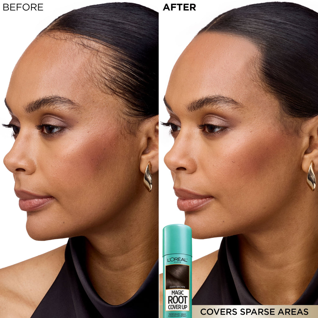 L'Oreal Paris Magic Root Cover Up Temporary Gray Concealer Spray, Dark Blonde, 2 oz