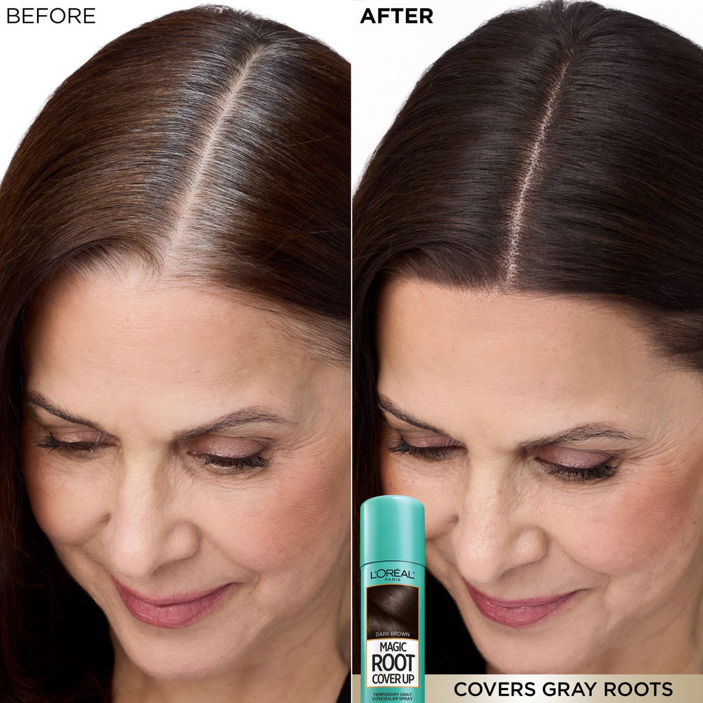 L'Oreal Paris Magic Root Cover Up Temporary Gray Concealer Spray, Dark Blonde, 2 oz