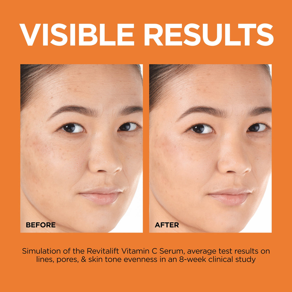 L'Oreal Paris Revitalift 12% Pure Vitamin C Serum, Brightening Serum for Face with Vitamin E, Salicylic Acid, 1 fl. oz.