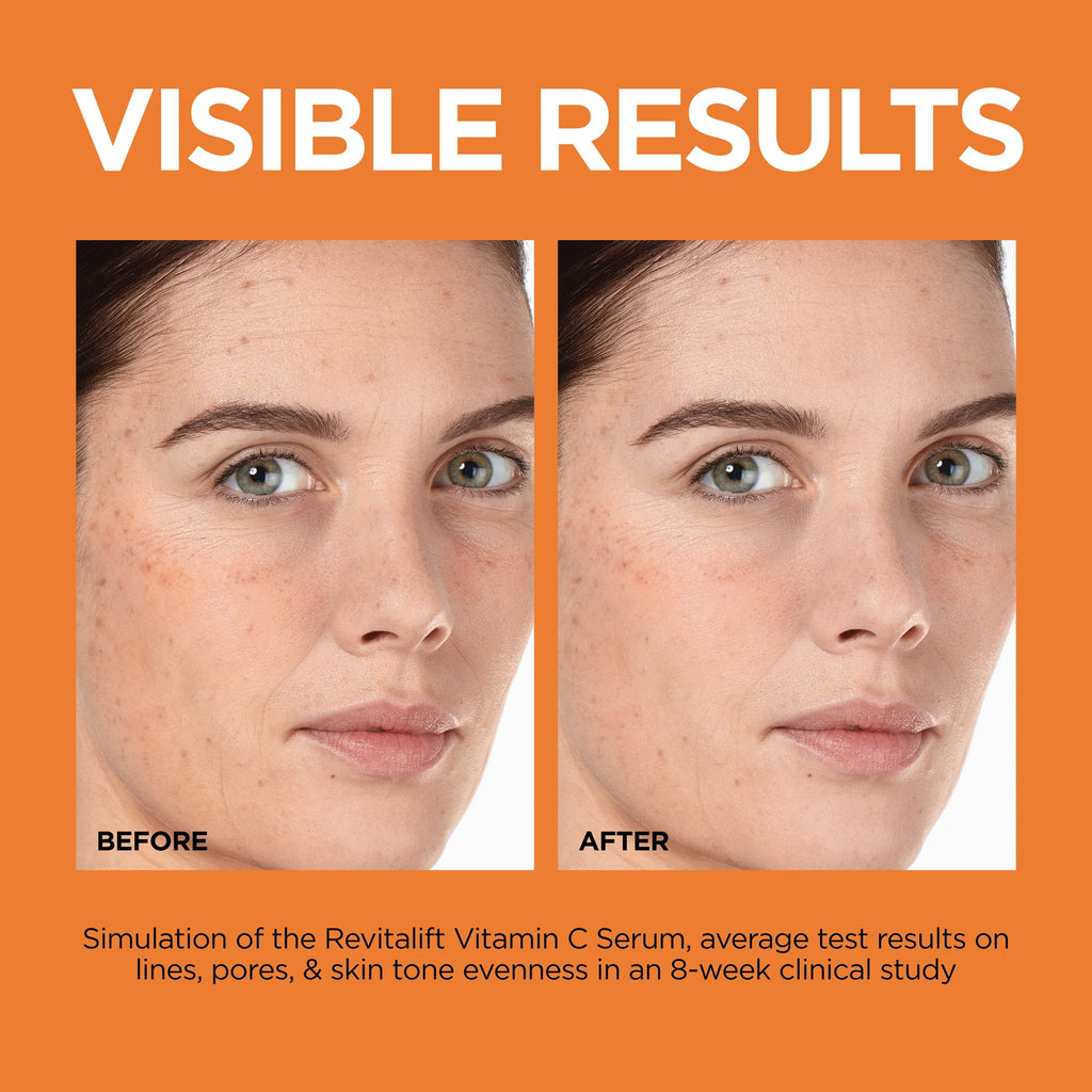 L'Oreal Paris Revitalift 12% Pure Vitamin C Serum, Brightening Serum for Face with Vitamin E, Salicylic Acid, 1 fl. oz.